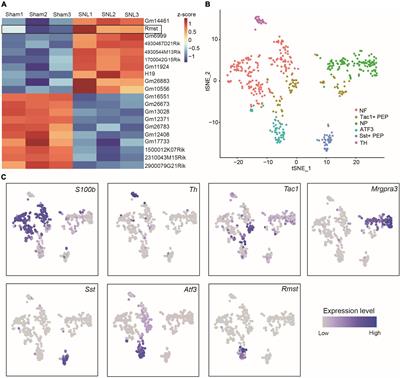 Long non-coding RNA rhabdomyosarcoma 2-associated transcript contributes to neuropathic pain by recruiting HuR to stabilize DNA methyltransferase 3 alpha mRNA expression in dorsal root ganglion neuron